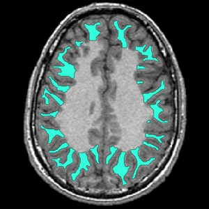 brain connectives
